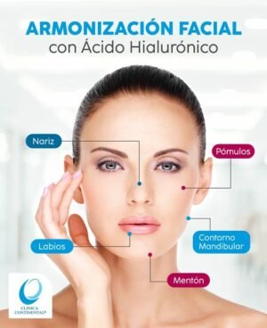 Tratamientos faciales - Armonización facial