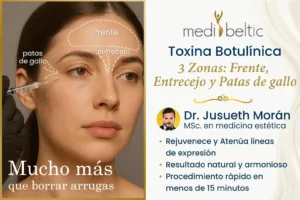 toxina botulinica precio Guayaquil Samborondón