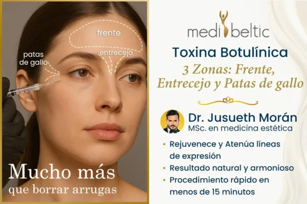 toxina botulinica precio Guayaquil Samborondón