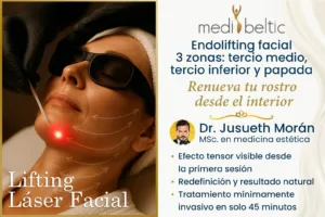 Endolifting facial precio Guayaquil Samborondón