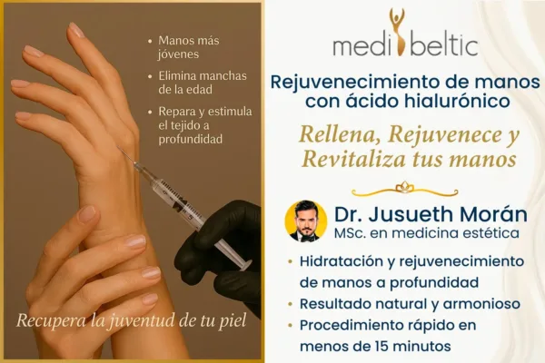 Rejuvenecimiento de manos con ácido hialurónico